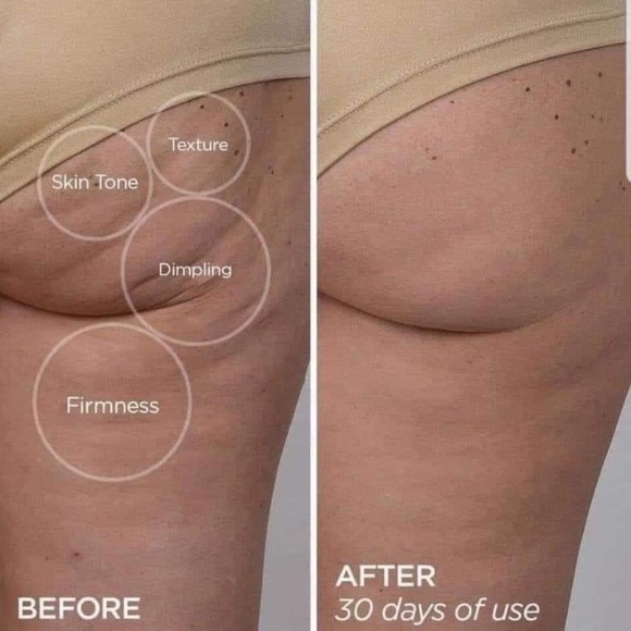 ageLOC® Dermatic Effects™ Body Contouring Lotion/Hibiscus Firming Cream - Picture 4 of 10